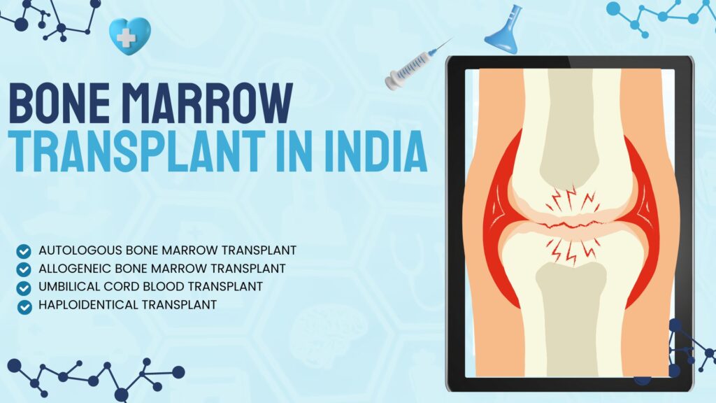 The Ultimate Guide to Bone Marrow Transplant in India