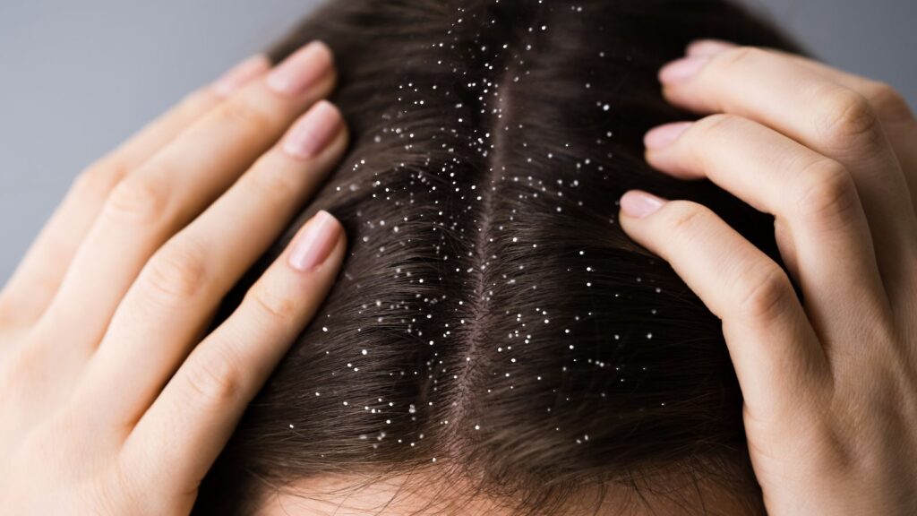 Bare Anatomy Anti Dandruff Shampoo Benefits & Uses