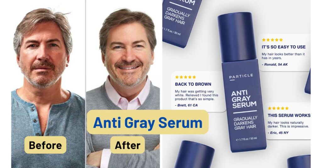 Time Machines Don't Exist, But Particle Anti-Gray Serum Does.