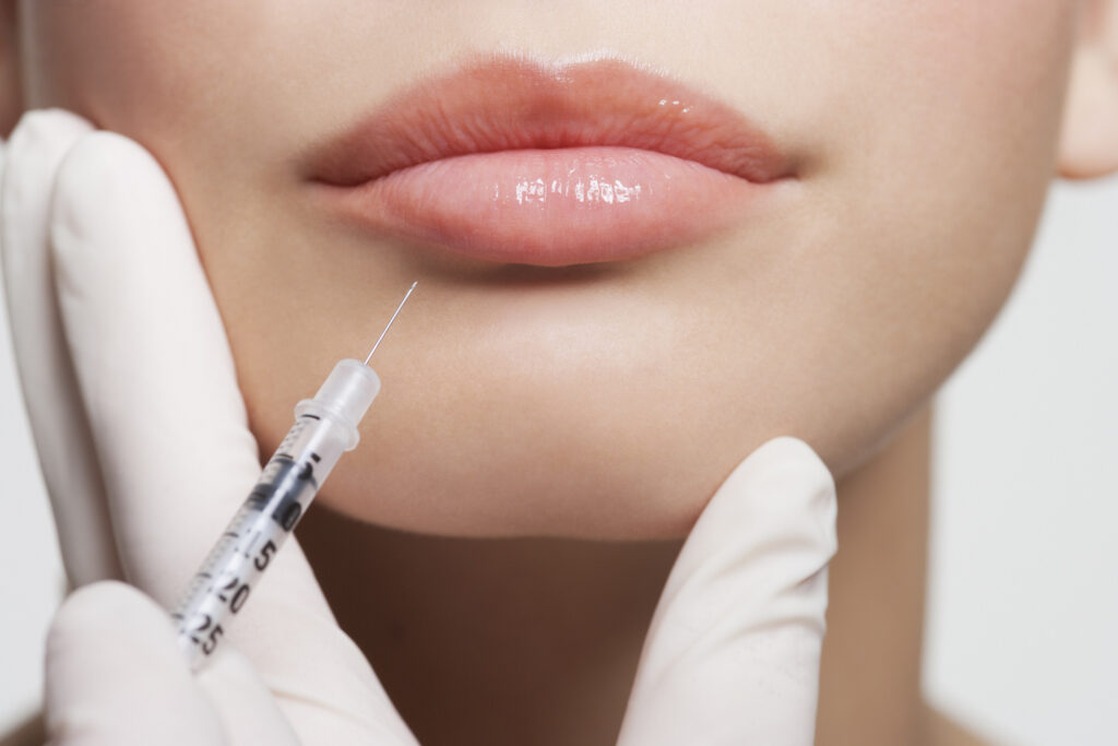 Common Myths About Lip Fillers