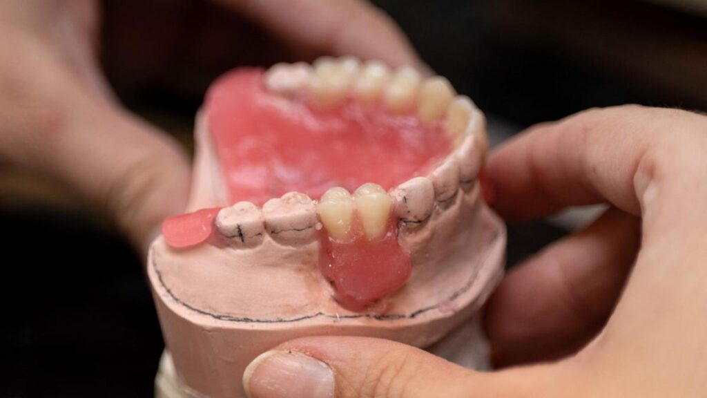 No insurance coverage, lack of government support are barriers to improving India’s dental care: experts
