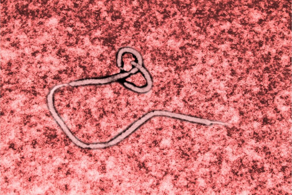 Ebola Virus