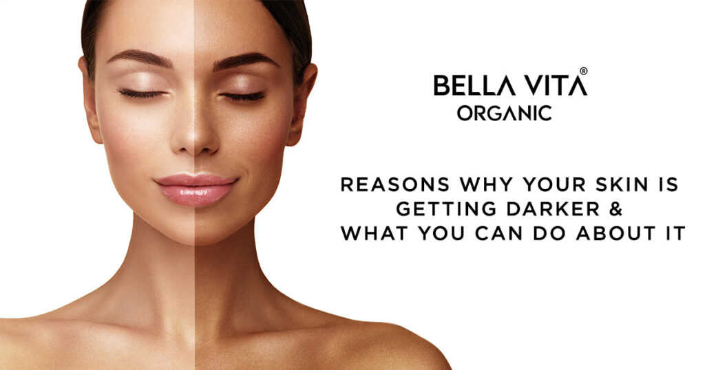 Reasons Why Your Skin is Getting Darker & What You Can Do About It
