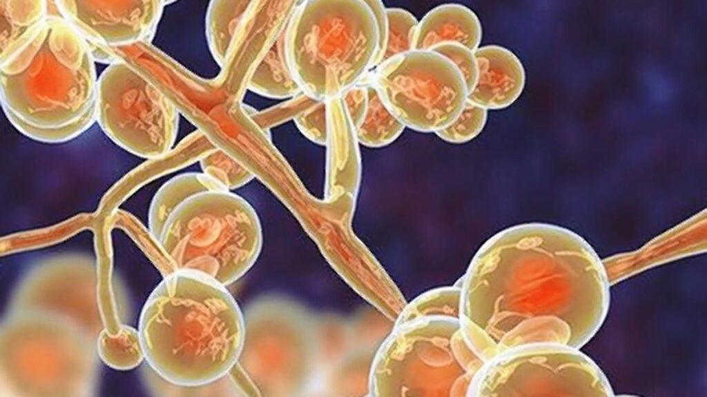 Surveillance, R&D innovation and communication are key levers for India to lead the fight against AMR