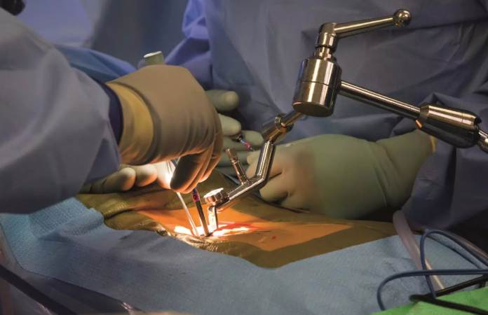 AI-Powered Predictive Analytics Enhances Spinal Surgery