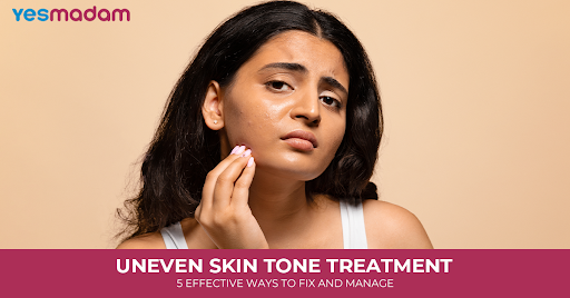 Uneven Skin Tone Treatment