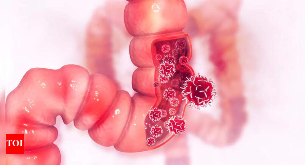 Colon Cancer: More powerful than pills? How this common practice helped colon cancer survivors live longer |