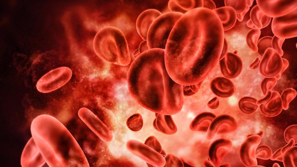 Rising cases of COVID-19 bring to fore associated threat of deep vein thrombosis