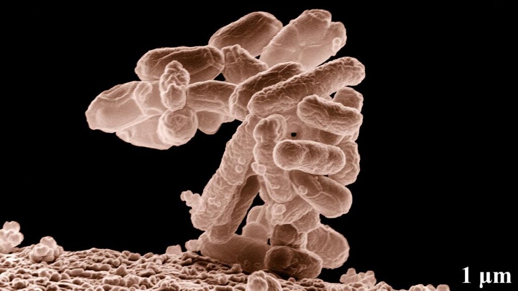 Nanoplastics can make E. coli infections worse: study