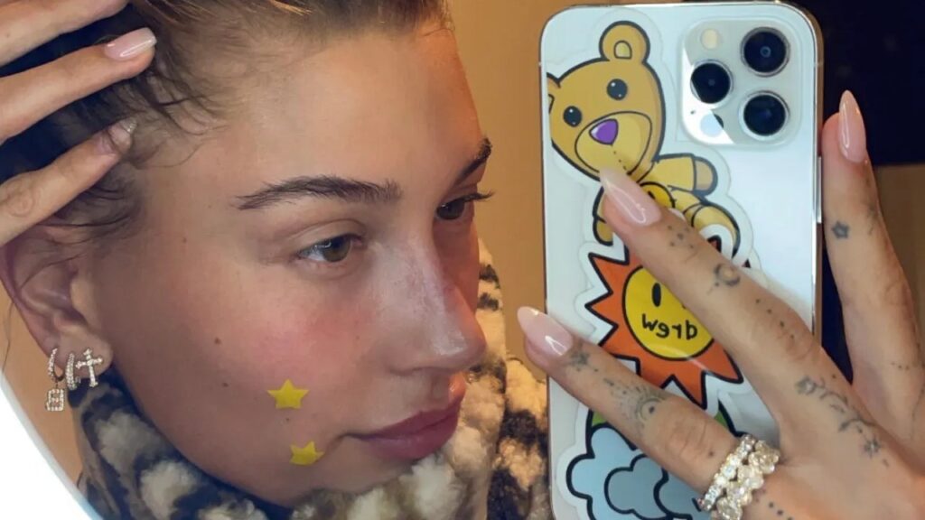How to make acne disappear in one hour, one day and one week